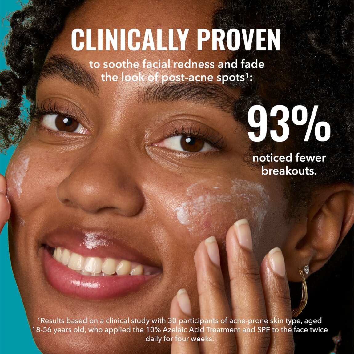 10% Azelaic Acid Treatment T0