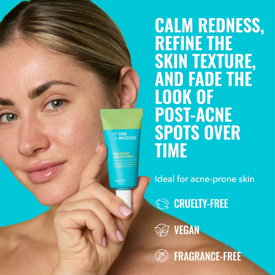 10% Azelaic Acid Treatment T0