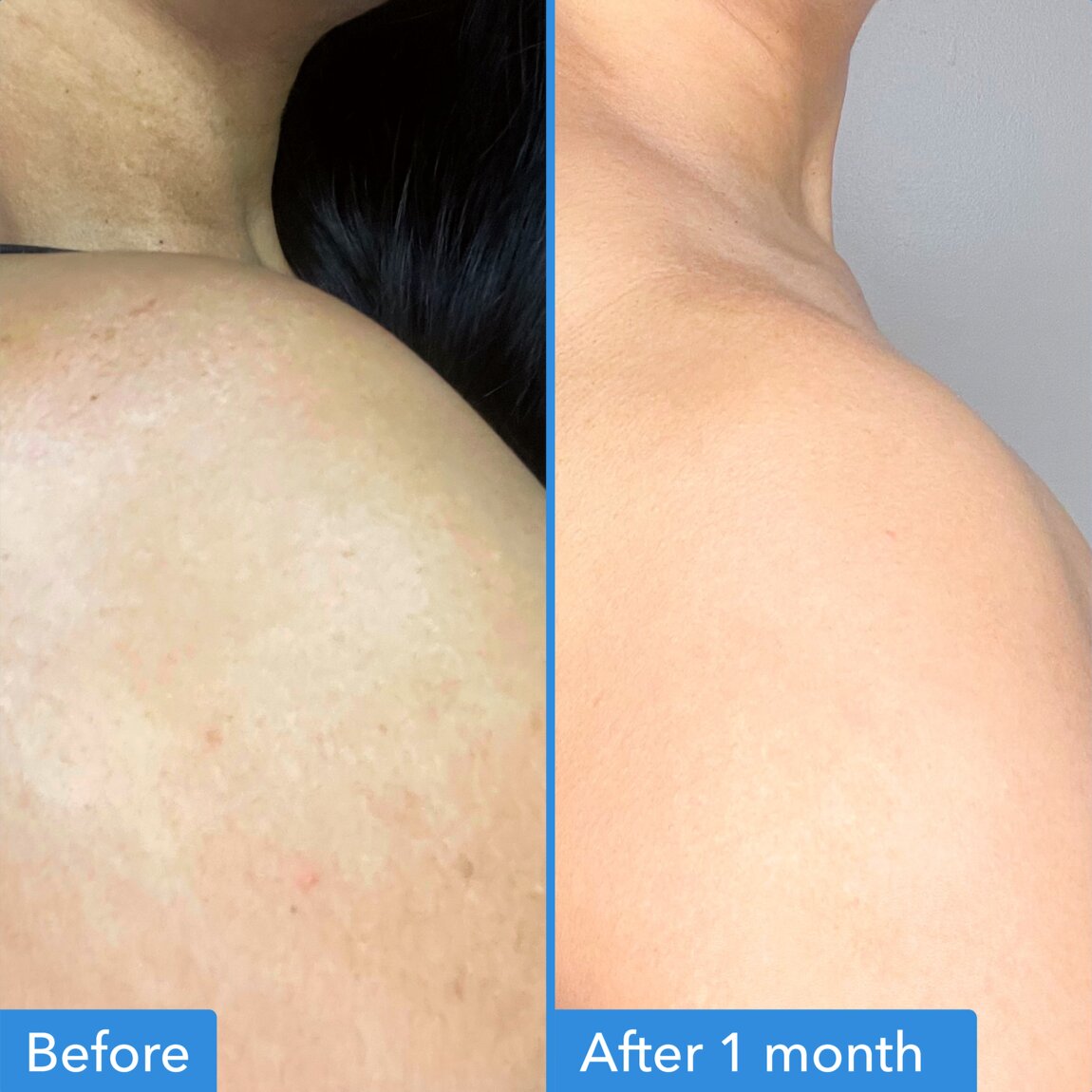Discoloration Correcting Body Treatment K7