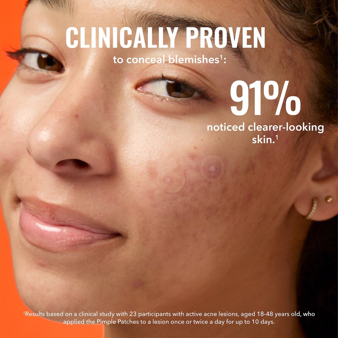 Pimple Patches A5