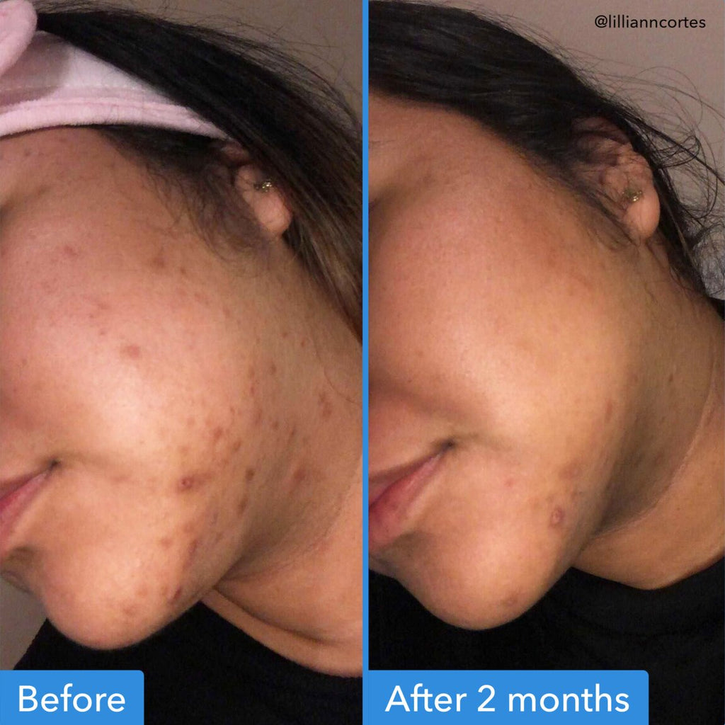 Discoloration Correcting Serum B5