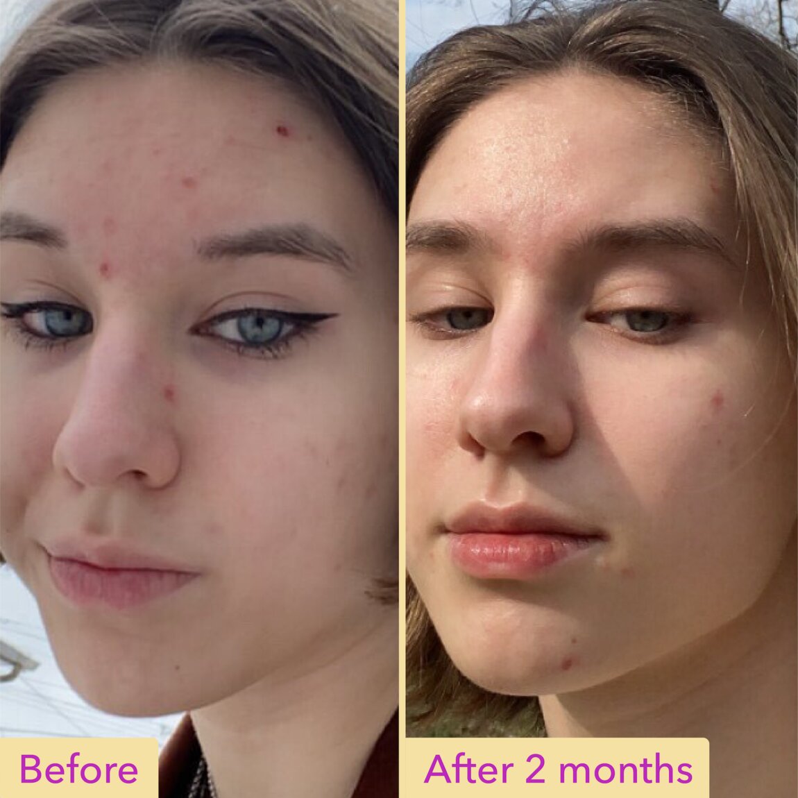 Niacinamide Serum M4