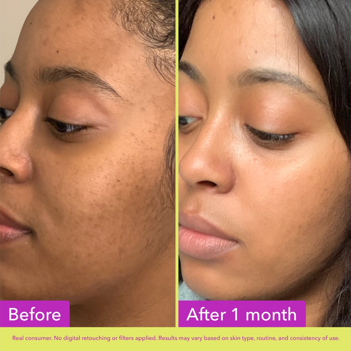 Glycolic Exfoliating Toner W2
